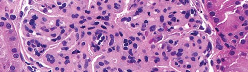 JSAP-clinical-article-pic